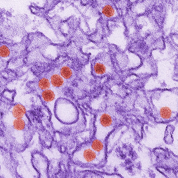 Digitally colorized transmission electron microscopic image of Zika virus
