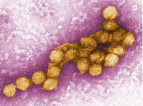 Image of West Nile virus under a microscope.