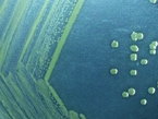 Thumbnail image: Multidrug Resistant Shigellosis
