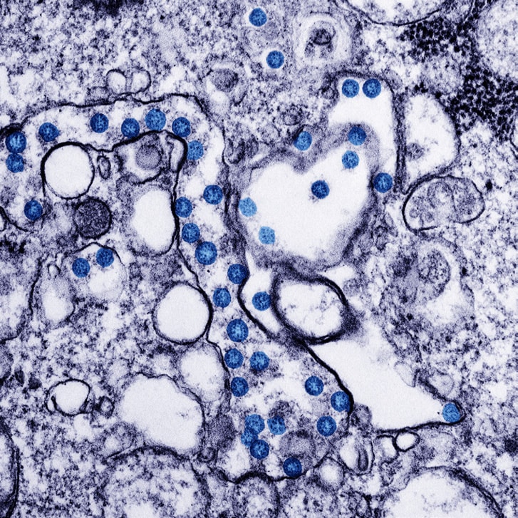 Electron microscopic image of infected tissues