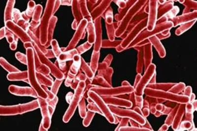 3-D rendering of tuberculosis as long, red rods on a black background