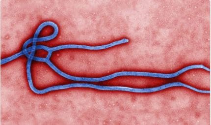 Ebola organism up close