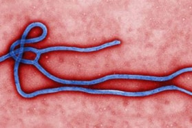 ebola organism up close
