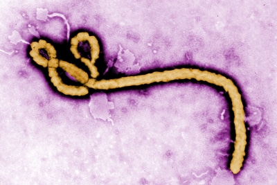 Image of yellow virus on purple background