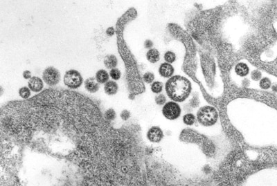 electron micrograph of lassa fever white and black