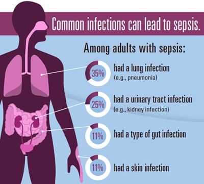 Cropped image from the sepsis fact sheet 