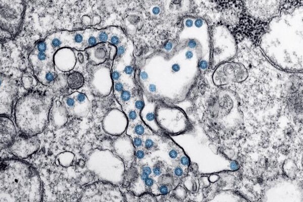 Mpox under the microscope