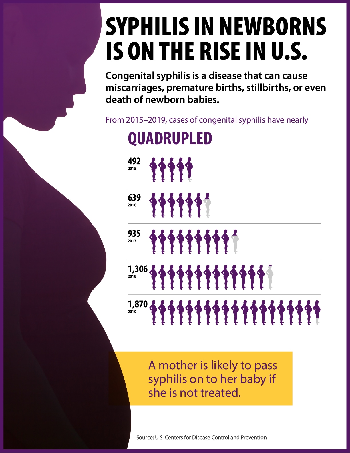 Syphilis in Newborns Is on the Rise in U.S.  The graphic states that congenital syphilis is a disease that can cause miscarriages, premature births, stillbirths, or even death of newborn babies.   The graphic shows that cases of congenital syphilis have nearly quadrupled between 2015 and 2019. There were 492 cases of congenital syphilis in 2015, 639 cases in 2016, 935 cases in 2017, 1,306 cases in 2018, and 1,870 cases in 2019.  The graphic states a mother is likely to pass syphilis on to her baby if she is not treated. 