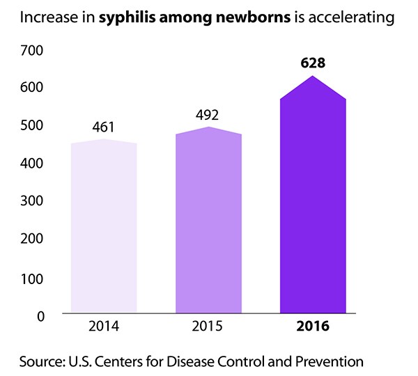 Increase in syphilis among newborns is accelerating