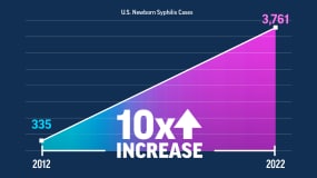 Graph showing the increase in U.S. newborn syphilis cases