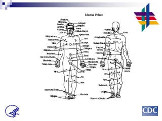 Diagram of human body: PCSI is also like Marma points in yoga, these are energy pathways for healing.