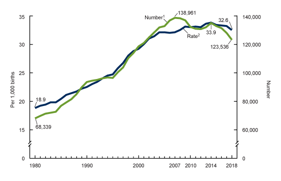 United States Birth Rate Chart