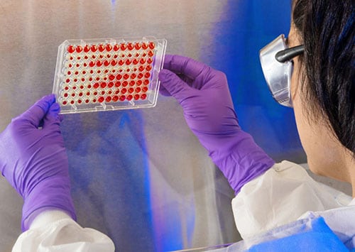 lab worker examines sample
