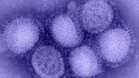 Ncird Restored CDC | CDC’s Influenza Risk Assessment Tool (IRAT) | NCIRD | CDC