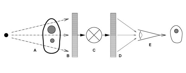 Figure 1. The examination of patients with digital radiography is illustrated as a six component model; A) generation of a beam of x-rays incident on the patient, B) modulation of the x-ray beam intensity by tissue structures, C) detection of the transmitted x-ray beam and creation of an array of raw image values ( Iraw ), D) transformation of Iraw values to presentation values ( Ip ) by display processing, E) display of the image with a standardized grayscale, and F) psycho-visual interpretation of the displayed image by the observer. 