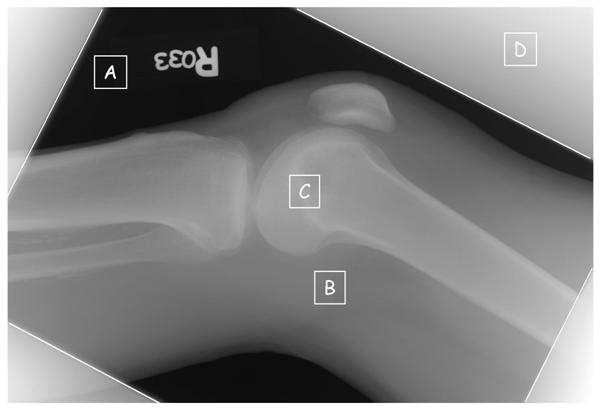 Figure 2a. Commonly observed regions are identified on an image of raw values, Iraw, from a knee radiograph; A) regions where the x-ray beam directly exposes the detector with no tissue attenuation, B) regions of modest tissue attenuation, C) regions of high attenuation from bone, and D) regions outside of the collimator edges exposed by scattered radiation.