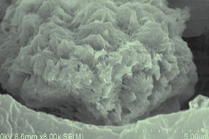 A magnification of a spongy-looking particle fills this image. Along the bottom are tick marks indicating measurement. In the bottom right hand corner, just under the tick marks, is numerical notation 5.00um