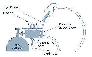 image of vacuum system