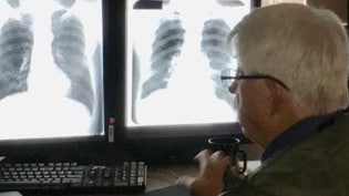 A physician reviewing digital chest x-rays.