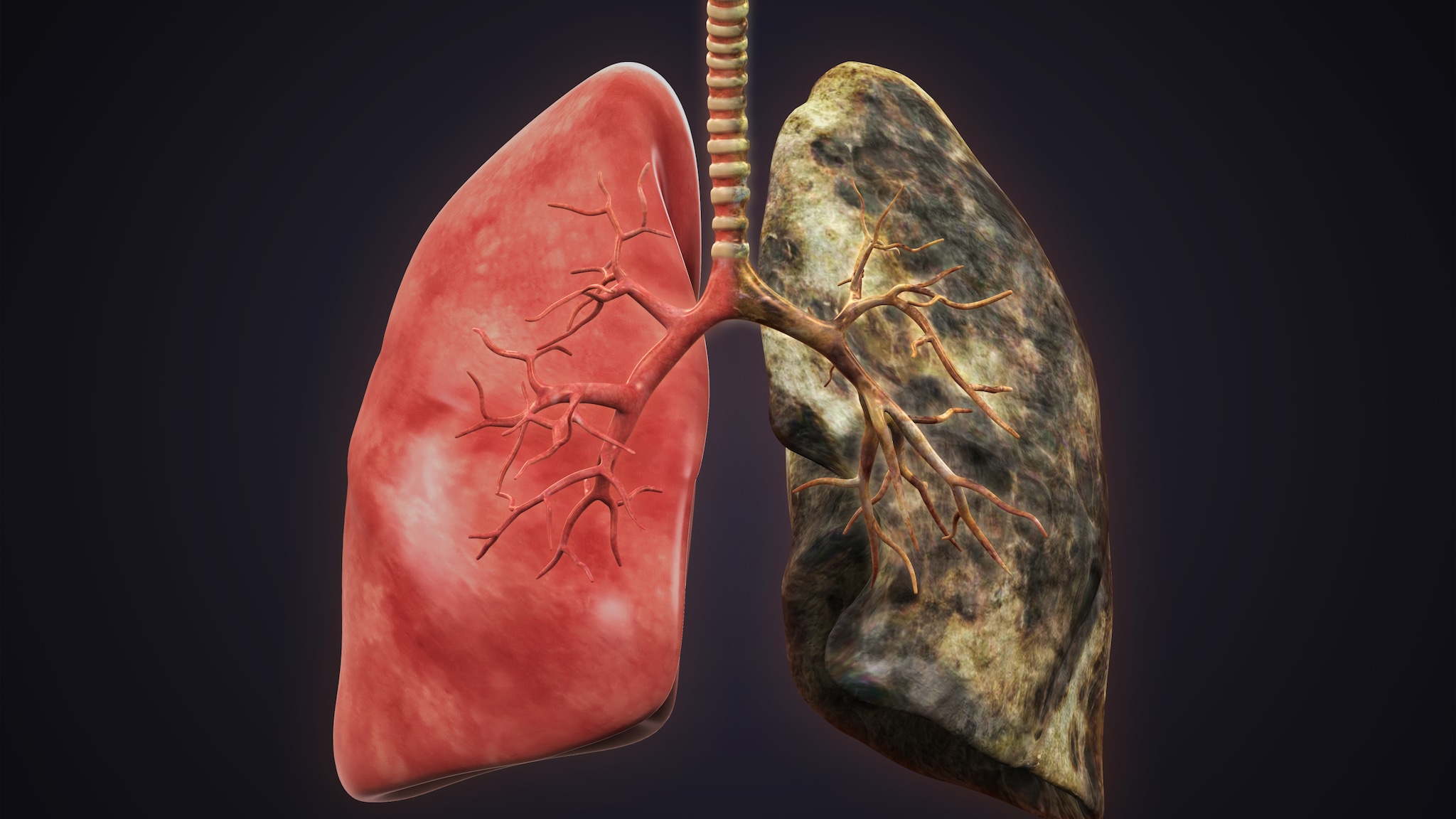 Picture of a healthy lung on one side and black lung on the other.