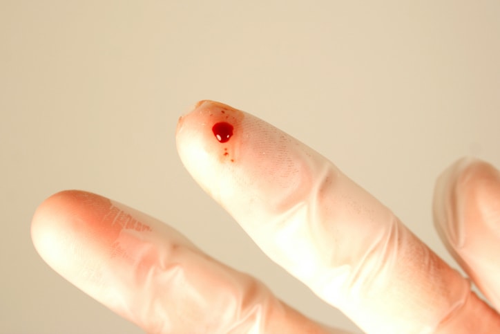 Hand wearing surgical glove with a finger prick and blood.