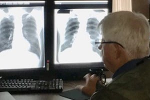 man viewing a chest xray
