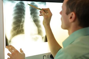 Person looking at a lung x-ray