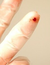finger prick showing blood drop