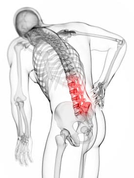 Skeletal image with highlighted back pain.