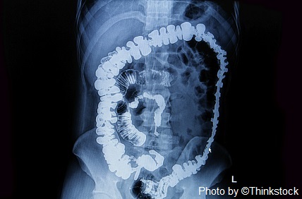 M3G x-ray of small and large intestines