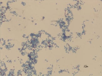 Modified Kinyoun’s acid-fast stain of Nocardia cyriacigeorgica grown on sheep blood agar 5 days at 35C, 100X
