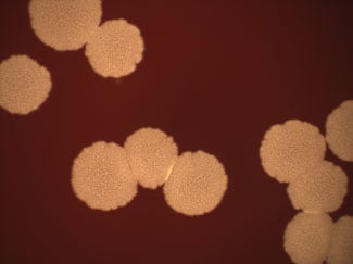 Nocardia cyriacigeorgica colonies on sheep blood agar 5 days at 35C, 2.0X