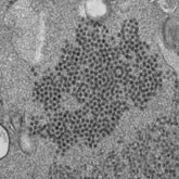 This thin section transmission electron micrograph (TEM) reveals numerous, spheroid-shaped Enterovirus-D68 (EV-D68) virions, which are members of the family Picornaviridae.