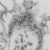 This thin section transmission electron micrograph (TEM) reveals numerous, spheroid-shaped Enterovirus-D68 (EV-D68) virions, which are members of the family Picornaviridae. Note that some of the viral particles appear as if they are “empty”, missing their contents of single-stranded RNA (ssRNA).