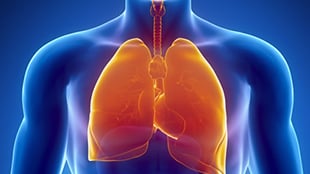 NSSP Development of Queries to Support Lung Injury Response