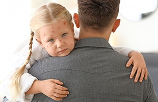 man taking care of little girl with chicken pox at home