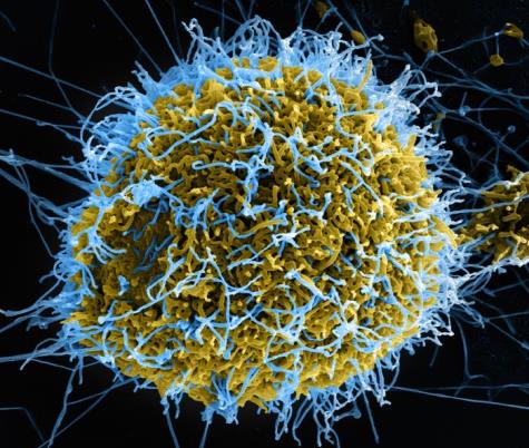 Human cell infected with ebola