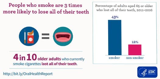 People who smoke are 3 times more likely to lose all of their teeth