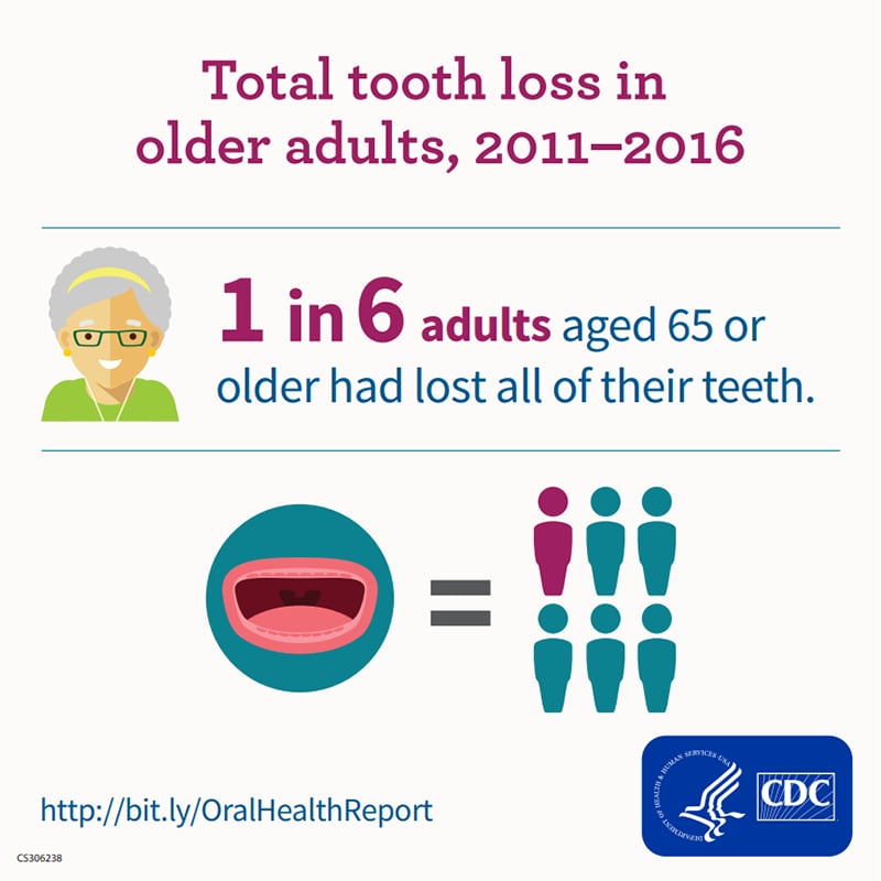Total tooth loss in older adults, 2011-2016. 1 in 6 adults aged 65 or older had lost all of their teeth.