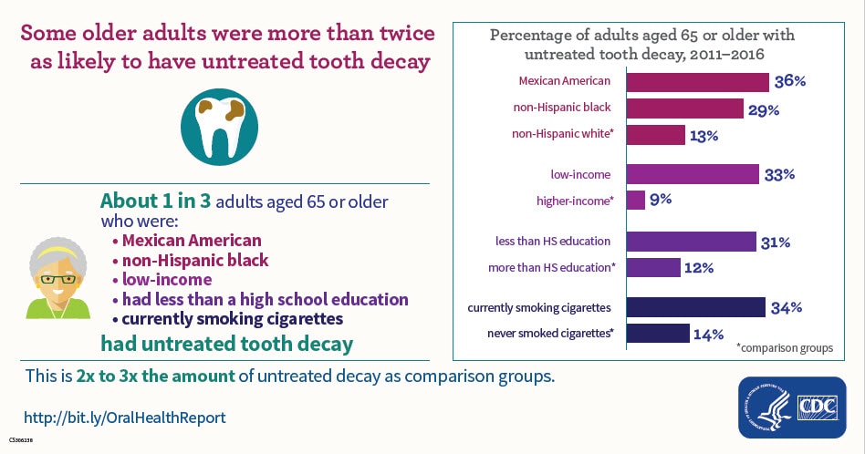 Untreated Cavities in Older Adults