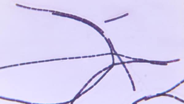 Microscopic image of anthrax