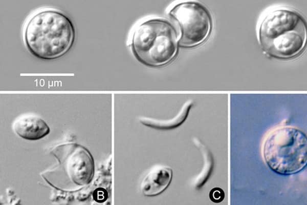 microscope images of microscopic parasite Cyclospora cayetanensis