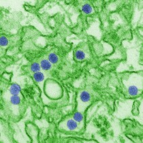 A digitally-colorized transmission electron microscopic image of Zika virus, a member of the family Flaviviridae (scientific name: flavivirus). More common flaviviruses include West Nile virus, dengue virus, tick-borne encephalitis virus, yellow fever virus, Zika virus, and more.