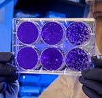 After staining the uninfected cells purple, the scientist will then count the clear spots on the plate, each representing a single virus particle. (Source: CDC PHIL.)