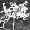 An image of Treponema pallidum, the causative agent of syphilis.