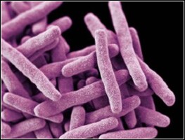 Highly magnified photo of tuberculosis