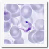 A microscopic image of a Trypomastigote form of Trypanosoma cruzi in a thin blood smear. The kinetoplast is the dense body visible at the superior end.