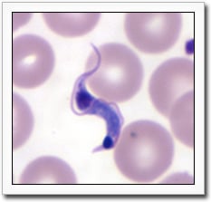 The trypomastigote form of Trypanosoma cruzi in a Giemsa stained peripheral blood smear from a patient with acute Chagas disease.