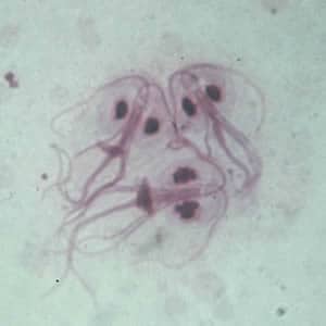 giardia stomach parasite)