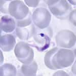 <em>Trypansoma cruzi</em> parasite in a thin blood smear. Credit: DPDx